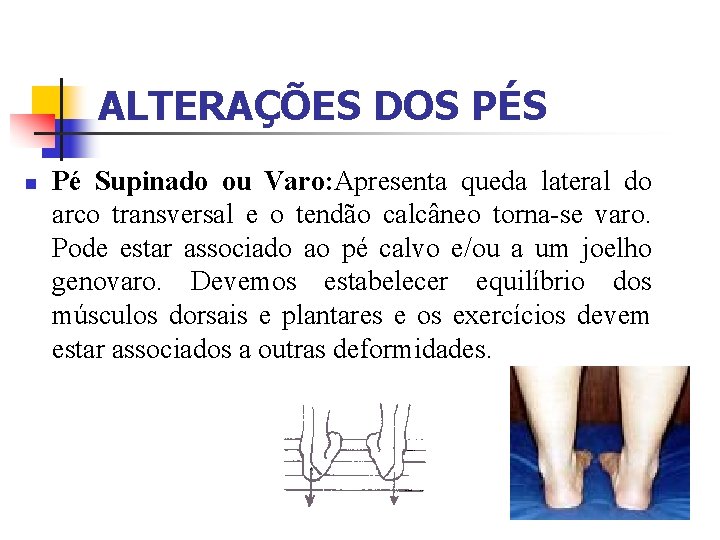 ALTERAÇÕES DOS PÉS n Pé Supinado ou Varo: Apresenta queda lateral do arco transversal