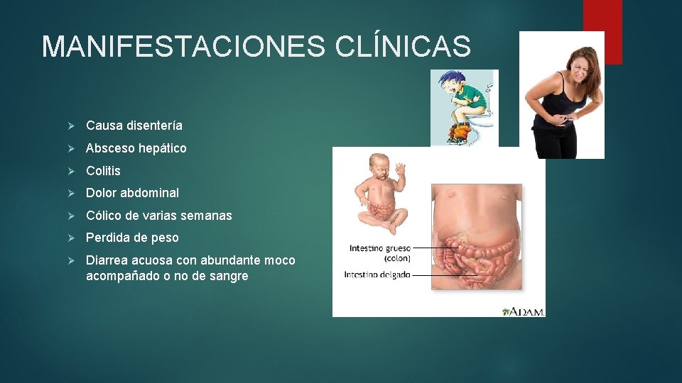 MANIFESTACIONES CLÍNICAS Ø Causa disentería Ø Absceso hepático Ø Colitis Ø Dolor abdominal Ø