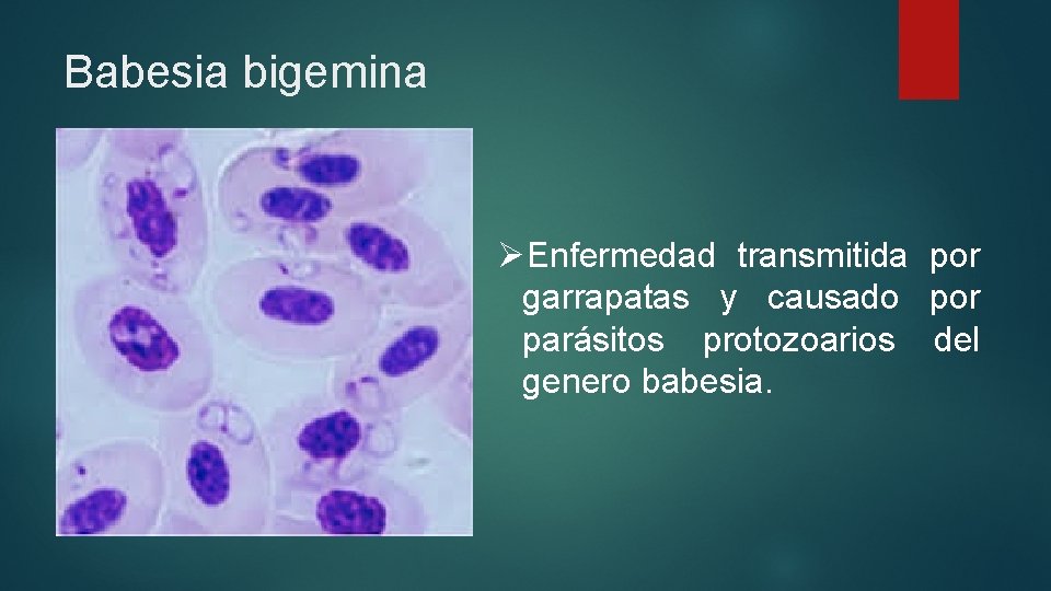 Babesia bigemina ØEnfermedad transmitida por garrapatas y causado por parásitos protozoarios del genero babesia.