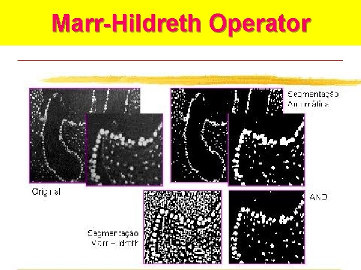 Marr-Hildreth Algorithm Marr-Hildreth Operator 