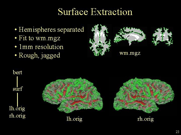 Surface Extraction • Hemispheres separated • Fit to wm. mgz • 1 mm resolution