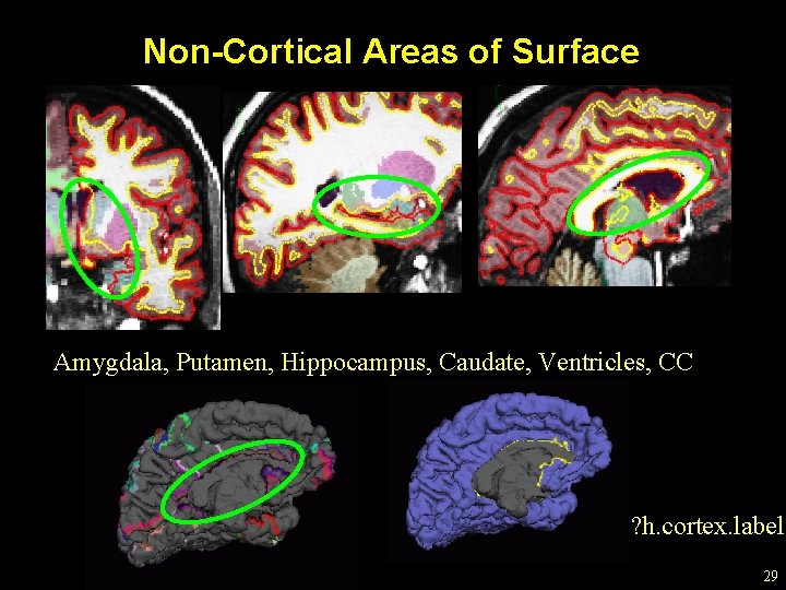 Non-Cortical Areas of Surface Amygdala, Putamen, Hippocampus, Caudate, Ventricles, CC ? h. cortex. label