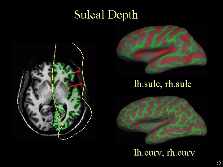 Sulcal Depth lh. sulc, rh. sulc lh. curv, rh. curv 60 