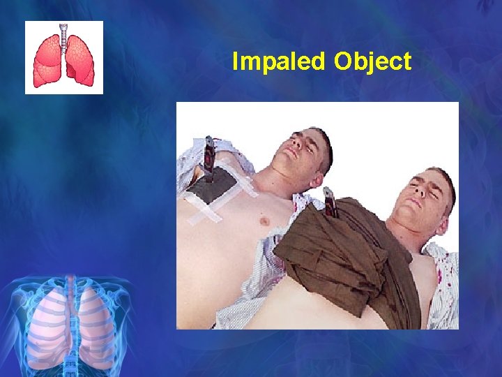 Impaled Object 