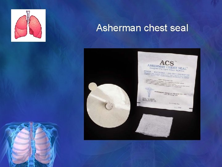 Asherman chest seal 