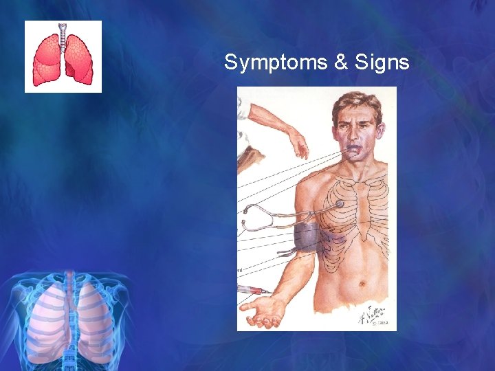 Symptoms & Signs 