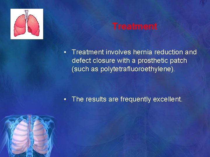 Treatment • Treatment involves hernia reduction and defect closure with a prosthetic patch (such