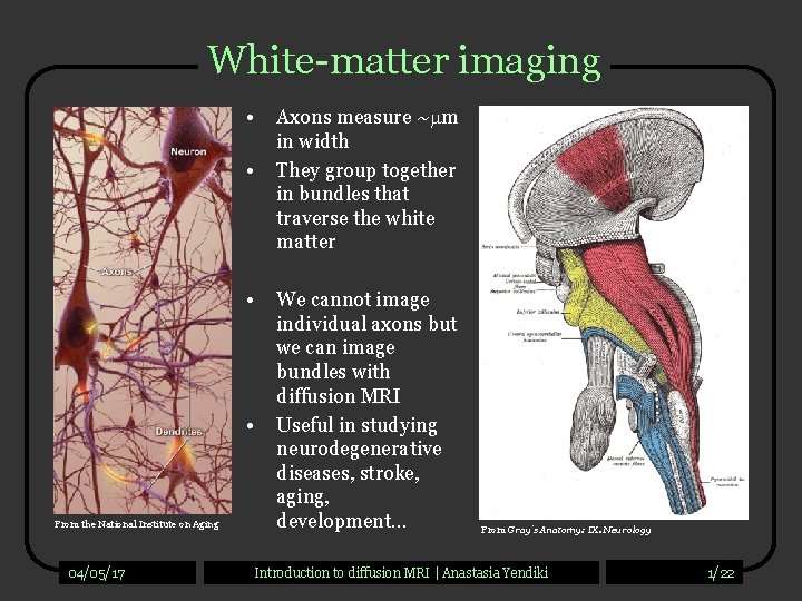 White-matter imaging • • From the National Institute on Aging 04/05/17 Axons measure ~