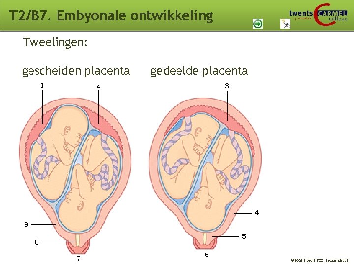 T 2/B 7. Embyonale ontwikkeling Tweelingen: gescheiden placenta gedeelde placenta © 2009 Biosoft TCC T 2/B 7. Embyonale ontwikkeling Tweelingen: gescheiden placenta gedeelde placenta © 2009 Biosoft TCC