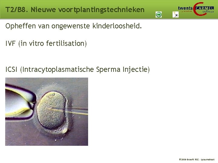 T 2/B 8. Nieuwe voortplantingstechnieken Opheffen van ongewenste kinderloosheid. IVF (in vitro fertilisation) ICSI T 2/B 8. Nieuwe voortplantingstechnieken Opheffen van ongewenste kinderloosheid. IVF (in vitro fertilisation) ICSI