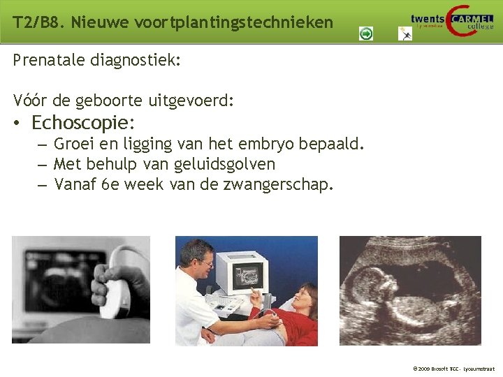 T 2/B 8. Nieuwe voortplantingstechnieken Prenatale diagnostiek: Vóór de geboorte uitgevoerd: • Echoscopie: – T 2/B 8. Nieuwe voortplantingstechnieken Prenatale diagnostiek: Vóór de geboorte uitgevoerd: • Echoscopie: –