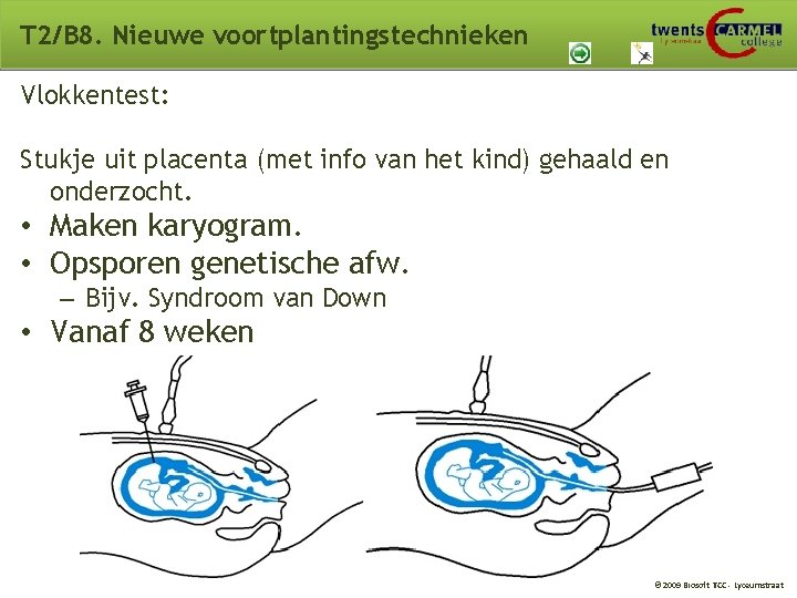 T 2/B 8. Nieuwe voortplantingstechnieken Vlokkentest: Stukje uit placenta (met info van het kind) T 2/B 8. Nieuwe voortplantingstechnieken Vlokkentest: Stukje uit placenta (met info van het kind)