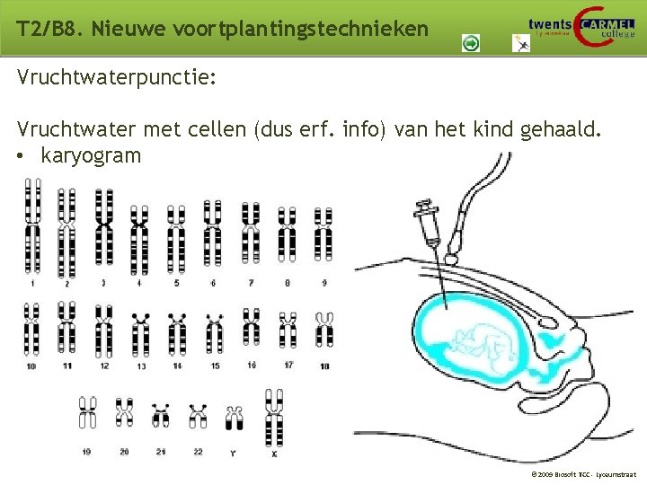 T 2/B 8. Nieuwe voortplantingstechnieken Vruchtwaterpunctie: Vruchtwater met cellen (dus erf. info) van het T 2/B 8. Nieuwe voortplantingstechnieken Vruchtwaterpunctie: Vruchtwater met cellen (dus erf. info) van het
