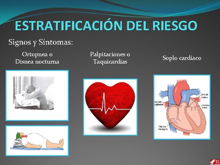 ESTRATIFICACIÓN DEL RIESGO Signos y Síntomas: Ortopnea o Disnea nocturna Palpitaciones o Taquicardias Soplo