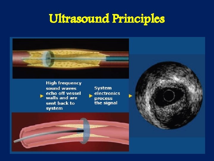 Ultrasound Principles 