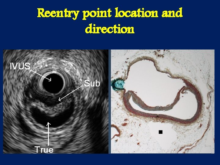 Reentry point location and direction 