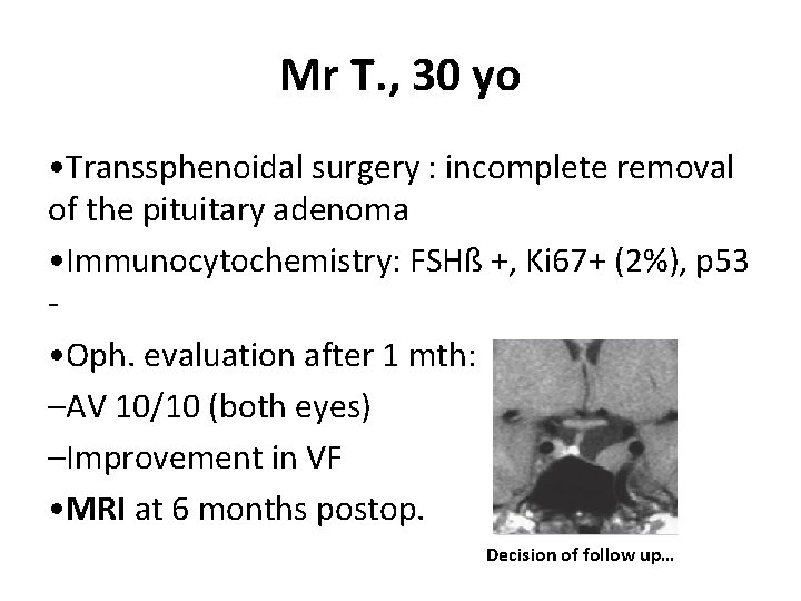 Mr T. , 30 yo • Transsphenoidal surgery : incomplete removal of the pituitary