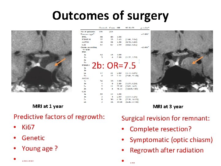 Outcomes of surgery 2 b: OR=7. 5 MRI at 1 year Predictive factors of