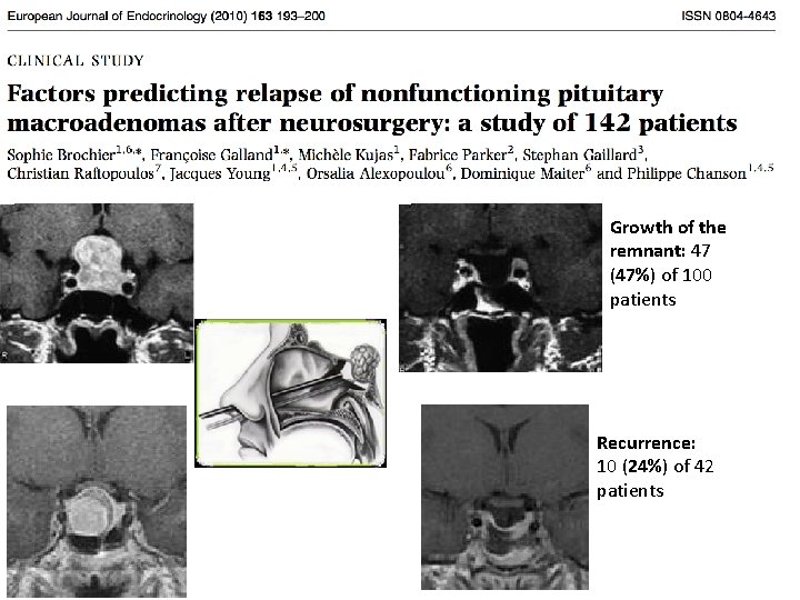 Growth of the remnant: 47 (47%) of 100 patients Recurrence: 10 (24%) of 42