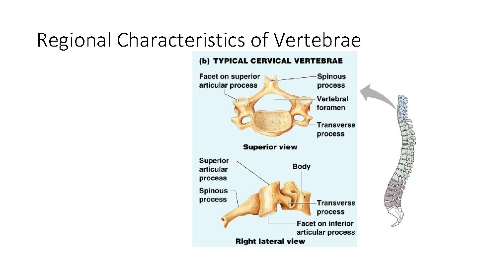 Regional Characteristics of Vertebrae Figure 5. 18 b 