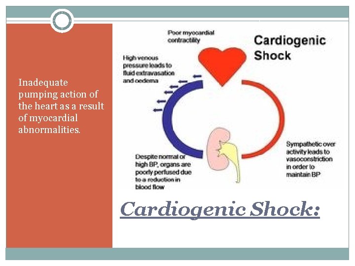 Inadequate pumping action of the heart as a result of myocardial abnormalities. Cardiogenic Shock: