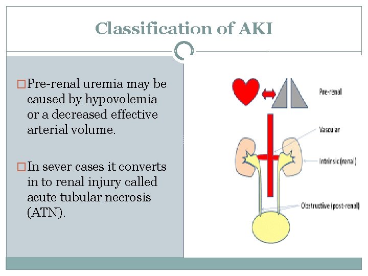 Classification of AKI �Pre-renal uremia may be caused by hypovolemia or a decreased effective