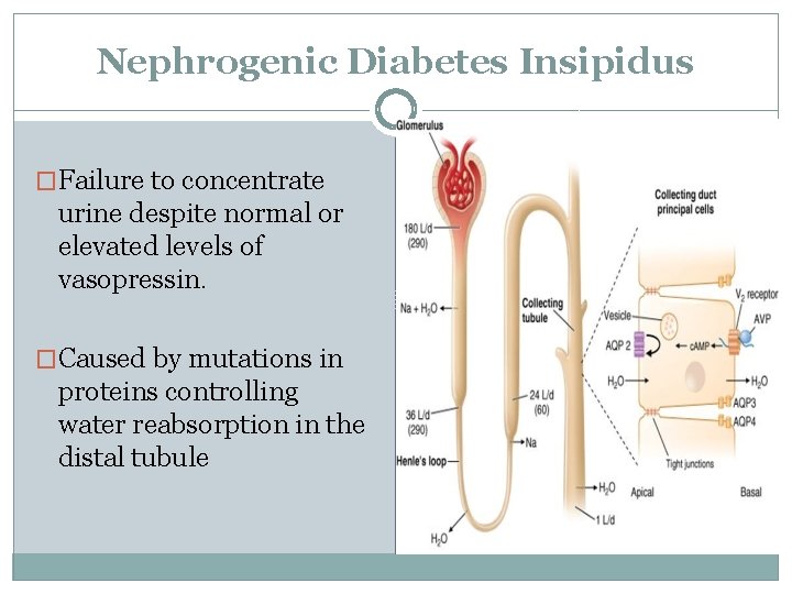 Nephrogenic Diabetes Insipidus �Failure to concentrate urine despite normal or elevated levels of vasopressin.