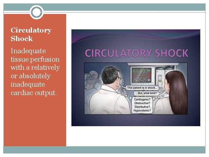 Circulatory Shock Inadequate tissue perfusion with a relatively or absolutely inadequate cardiac output. 