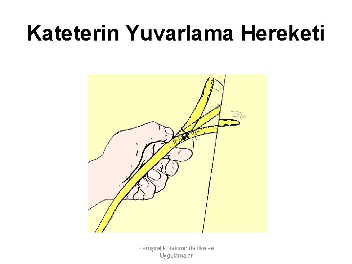 Kateterin Yuvarlama Hereketi Hemşirelik Bakımında İlke ve Uygulamalar 
