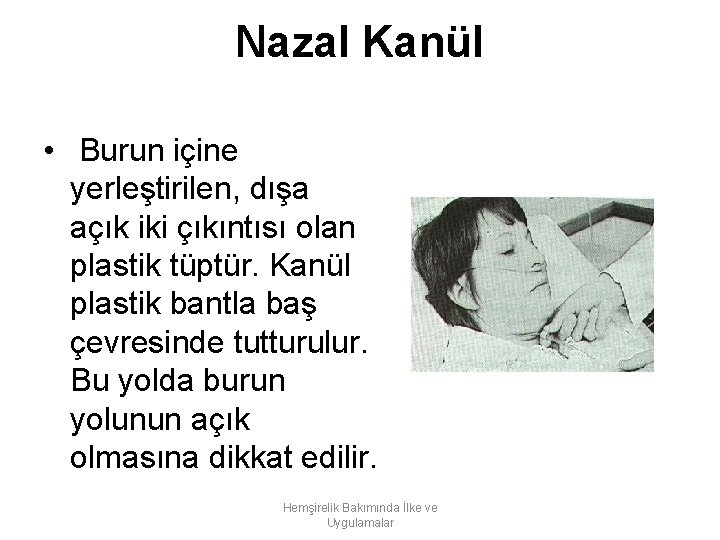 Nazal Kanül • Burun içine yerleştirilen, dışa açık iki çıkıntısı olan plastik tüptür. Kanül