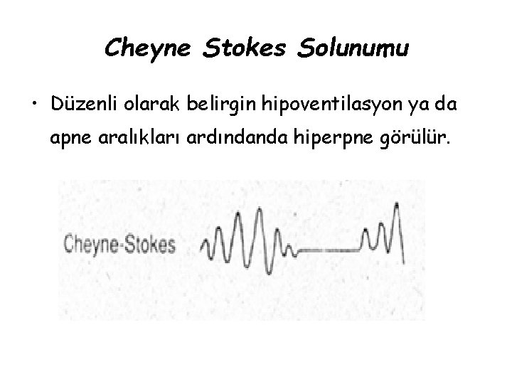 Cheyne Stokes Solunumu • Düzenli olarak belirgin hipoventilasyon ya da apne aralıkları ardındanda hiperpne