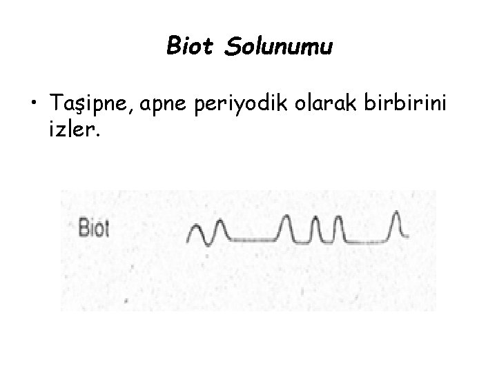 Biot Solunumu • Taşipne, apne periyodik olarak birbirini izler. 