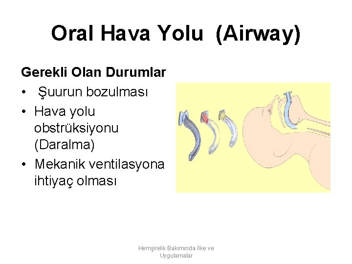 Oral Hava Yolu (Airway) Gerekli Olan Durumlar • Şuurun bozulması • Hava yolu obstrüksiyonu