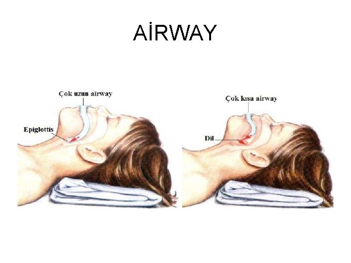 AİRWAY 