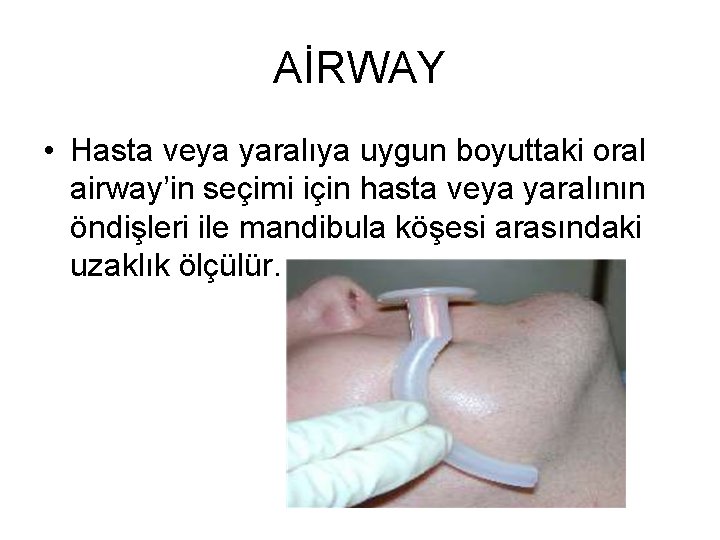 AİRWAY • Hasta veya yaralıya uygun boyuttaki oral airway’in seçimi için hasta veya yaralının