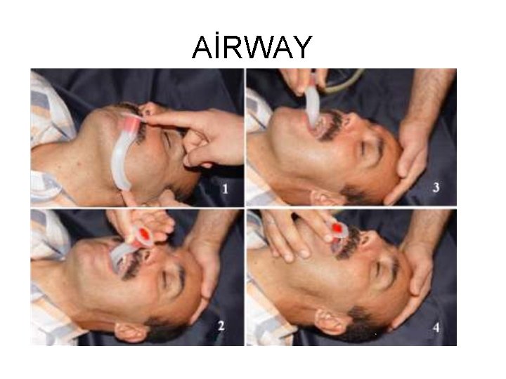 AİRWAY 