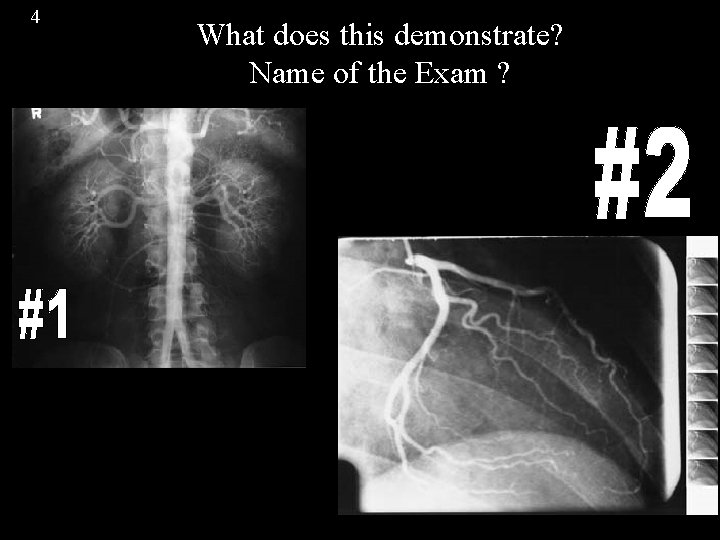 4 What does this demonstrate? Name of the Exam ? 