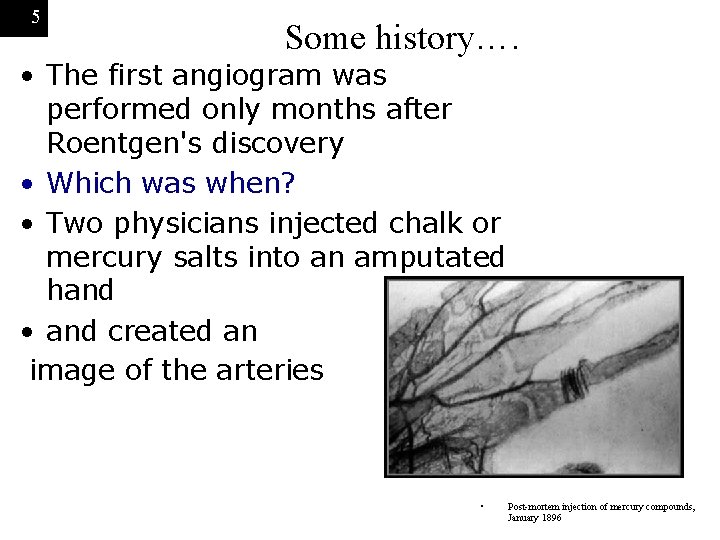 5 Some history…. • The first angiogram was performed only months after Roentgen's discovery