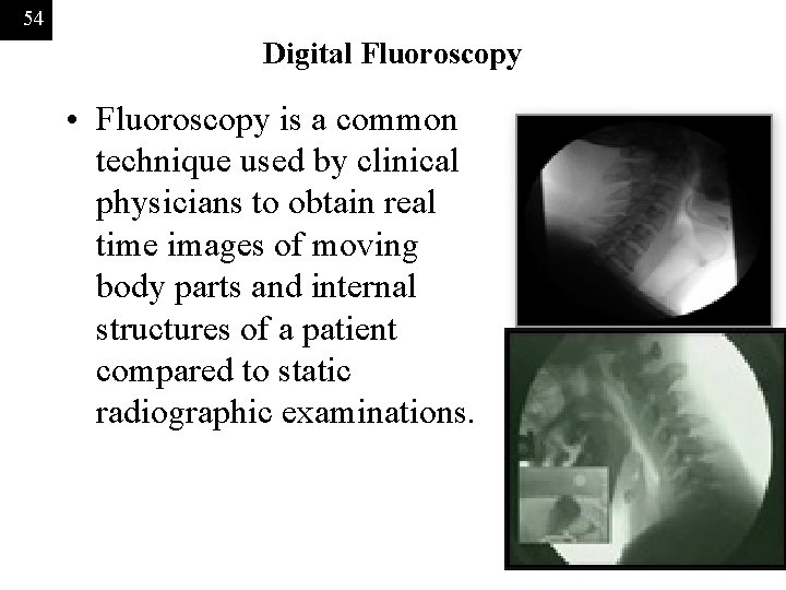 54 Digital Fluoroscopy • Fluoroscopy is a common technique used by clinical physicians to