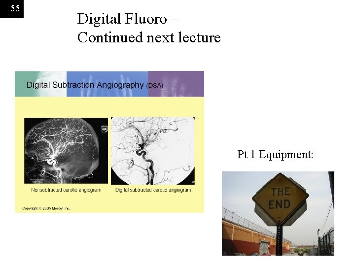 55 Digital Fluoro – Continued next lecture Pt 1 Equipment: 