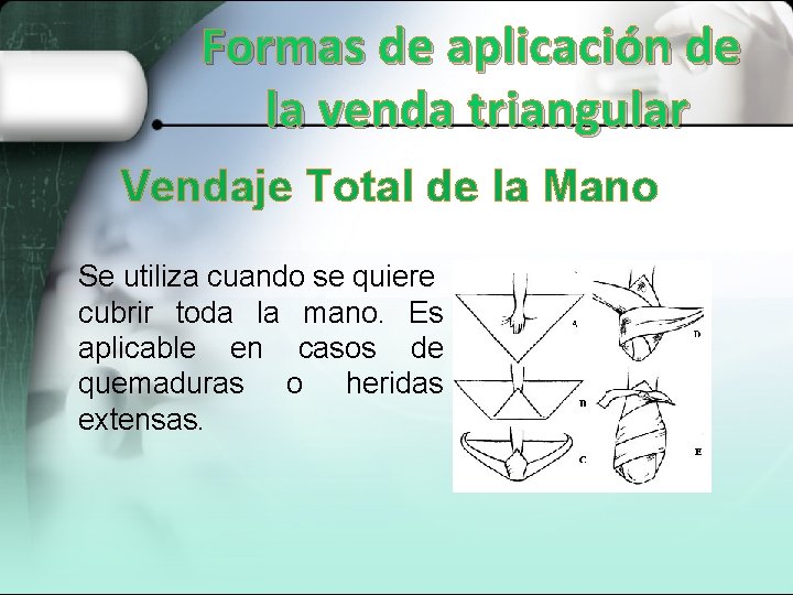 Formas de aplicación de la venda triangular Vendaje Total de la Mano Se utiliza