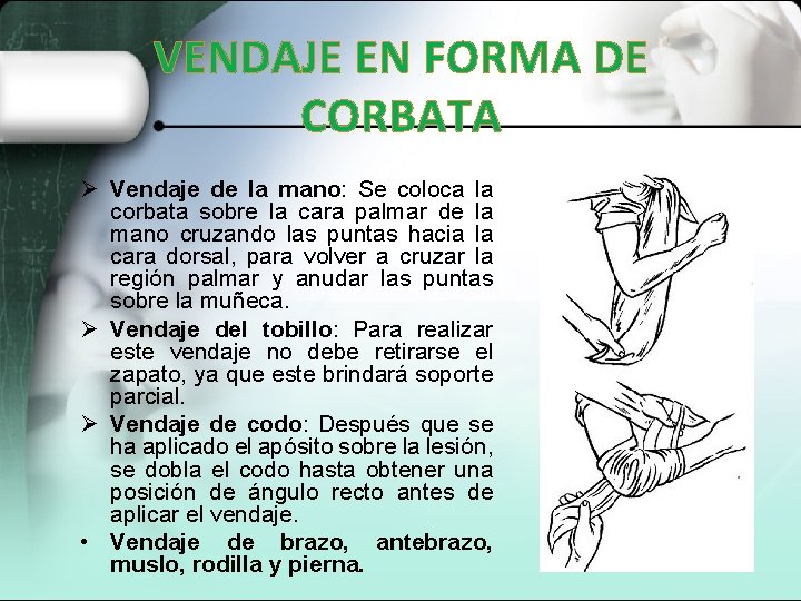 VENDAJE EN FORMA DE CORBATA Ø Vendaje de la mano: Se coloca la corbata