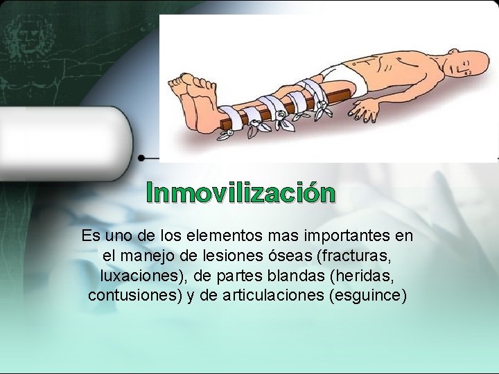 Inmovilización Es uno de los elementos mas importantes en el manejo de lesiones óseas