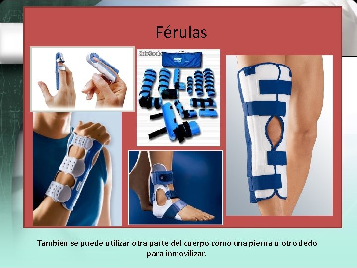 Férulas También se puede utilizar otra parte del cuerpo como una pierna u otro