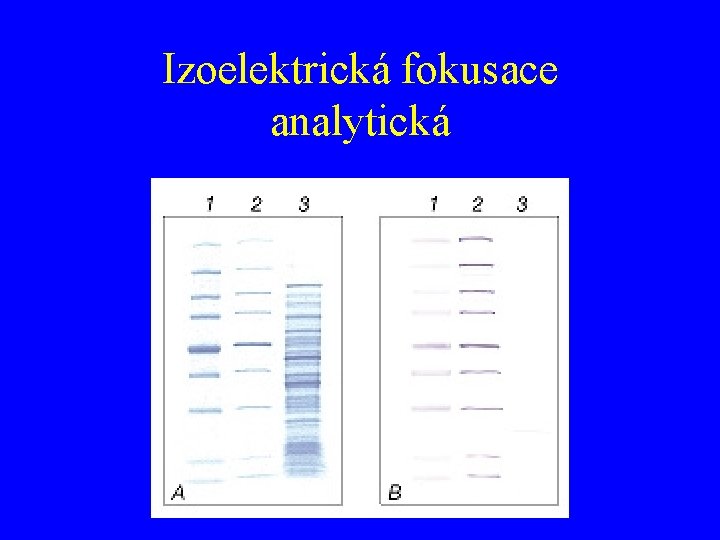 Izoelektrická fokusace analytická 