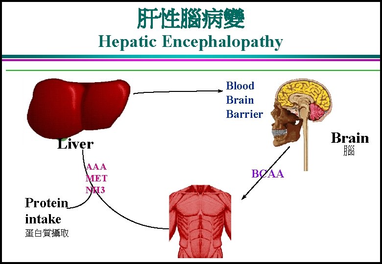 肝性腦病變 Hepatic Encephalopathy Blood Brain Barrier 肝 Brain Liver Protein intake 蛋白質攝取 腦 AAA