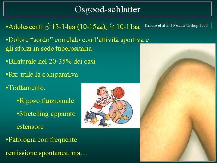 Osgood-schlatter • Adolescenti ♂ 13 -14 aa (10 -15 aa); ♀ 10 -11 aa