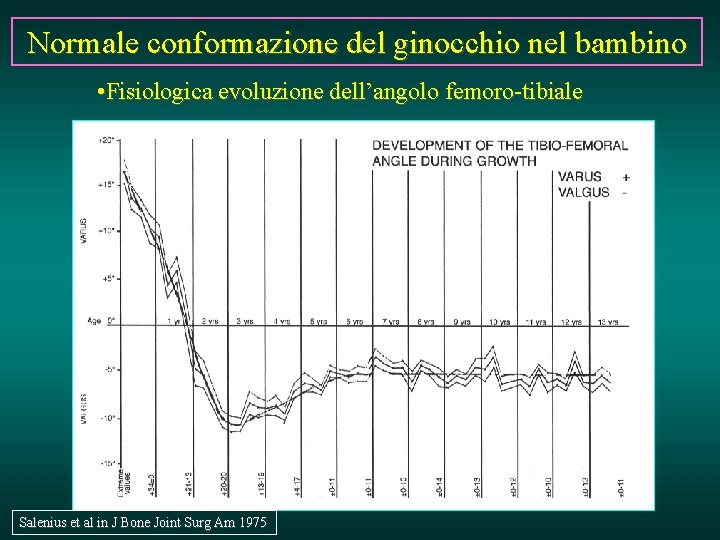 Normale conformazione del ginocchio nel bambino • Fisiologica evoluzione dell’angolo femoro-tibiale Salenius et al