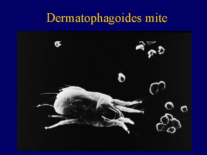 Dermatophagoides mite 