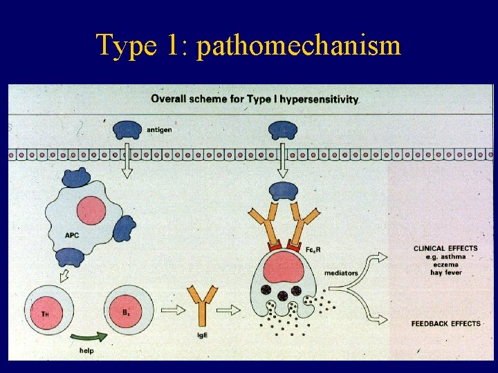 Type 1: pathomechanism 